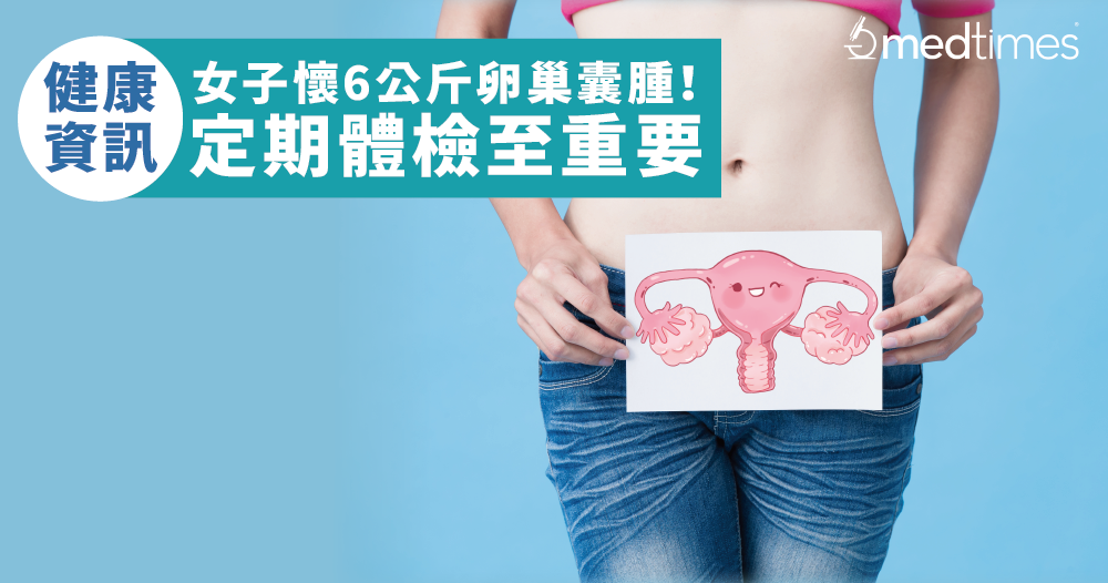 【健康資訊】女子懷6公斤卵巢囊腫！定期體檢至重要